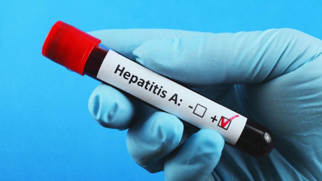 Počty případů žloutenky typu A letos v Česku trhají rekordy. Ilustrační foto: Depositphotos.com