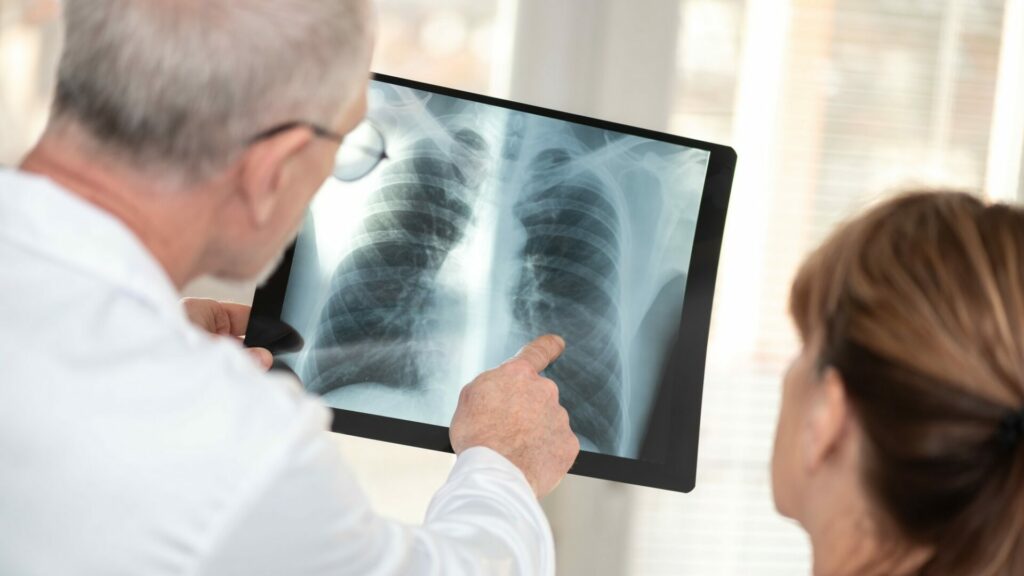 Lidé přijíždějící do Česka za prací musí projít vstupní lékařskou prohlídkou. Její součástí je i rentgen plic, který tuberkulózní ložiska odhalí. Ilustrační foto: Depositphotos.com